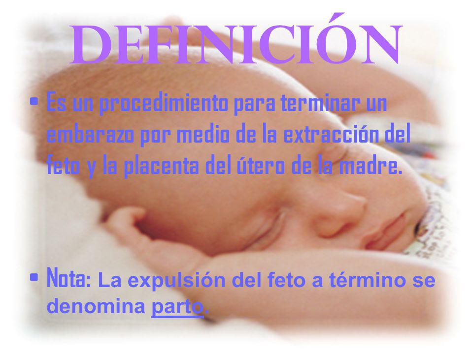 Que es interrumpir definicion